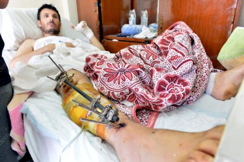 EGY01_14082014_MISI_GAZA