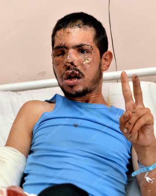 EGY03_15082014_GAZA