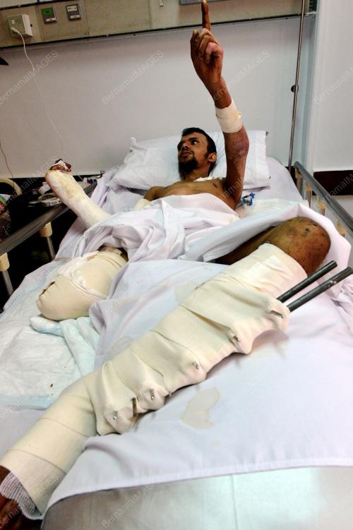 EGY09_14082014_MISI_GAZA