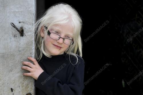 IBN01_10042019_MAPIM_ALBINO