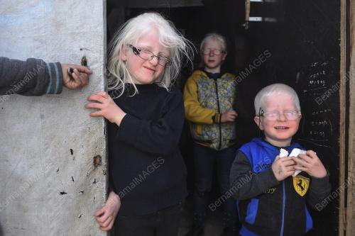 IBN03_10042019_MAPIM_ALBINO