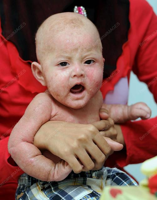 JB02_10042014_ANAK-HSI