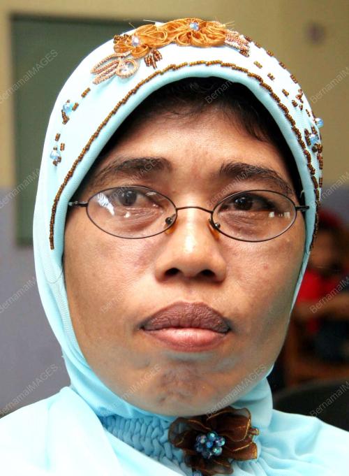 UMI ANA