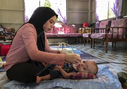 BAYI SEMBILAN BULAN DERITA Ã”PFEIFFER SYNDROMEÃ•