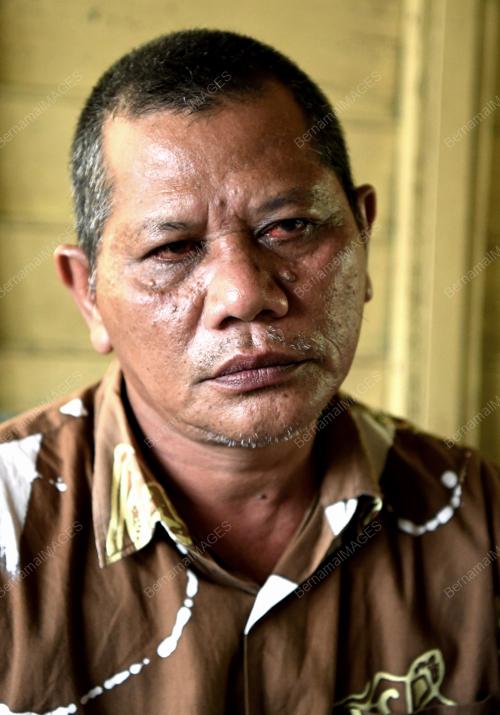 KB01_08112017_MANGSA_LEMAS