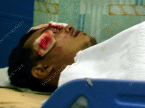 KEMALANGAN MAUT