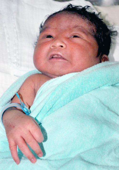 BAYI
