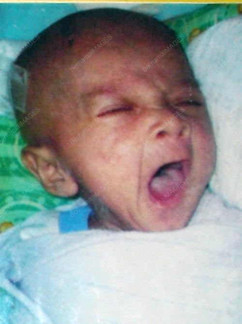 BAYI KEPALA BESAR