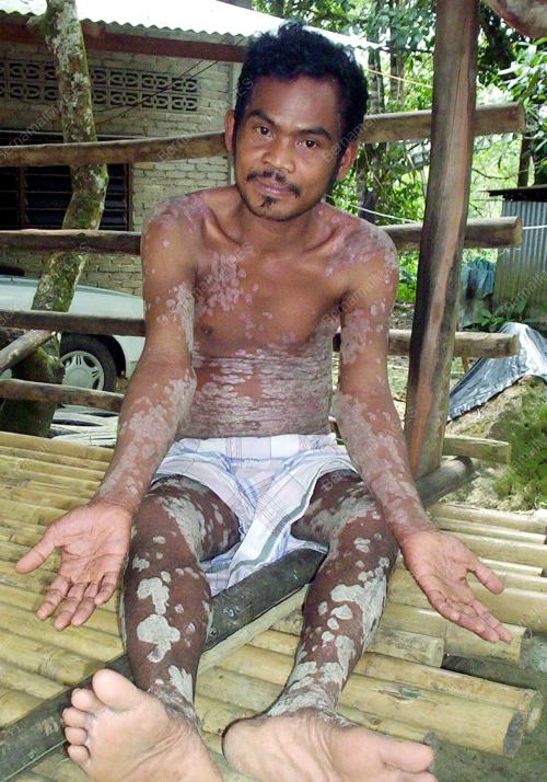 MOHD YATIM MAN