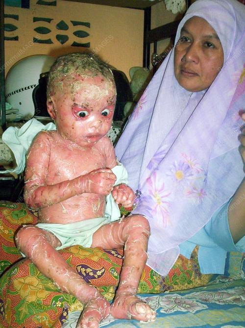 SALMIAH ABD RAHMAN
