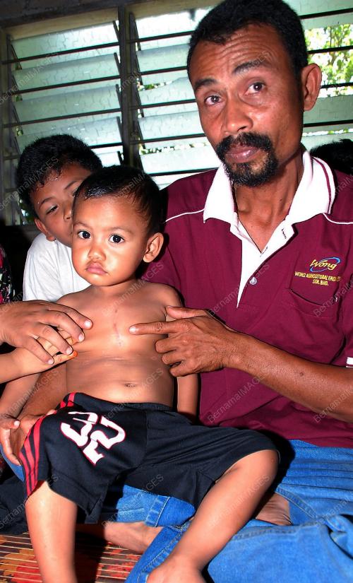 SAKIT RAYU BANTUAN