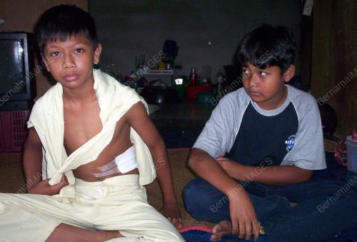 MANGSA MERCUN