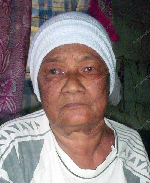 BEDAH SAAD