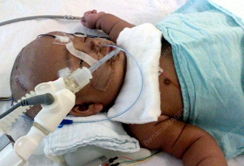 KD07_18072012_BAYI_DERA