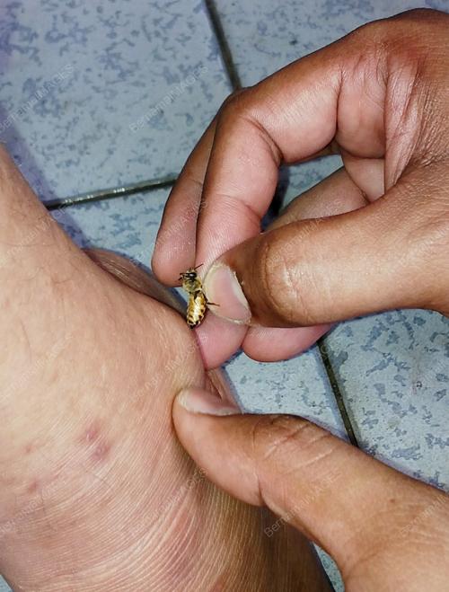 KL12_14082013_LEBAH_TERAPI
