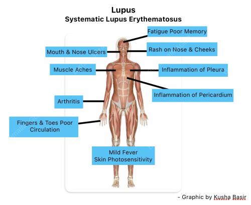 PENYAKIT LUPUS