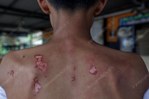 MANGSA KEBAKARAN SALURAN PAIP GAS