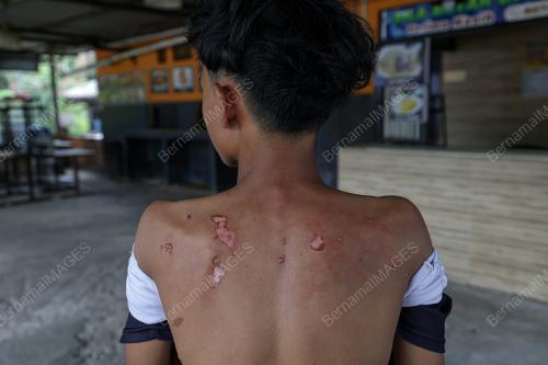 MANGSA KEBAKARAN SALURAN PAIP GAS