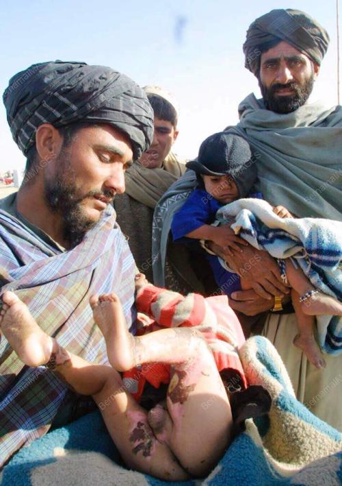 PAK02_05022016_TERBAKAR