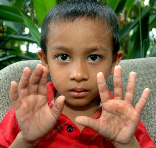 TANGAN_GATAL