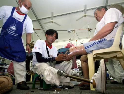 FREE PROSTHESIS