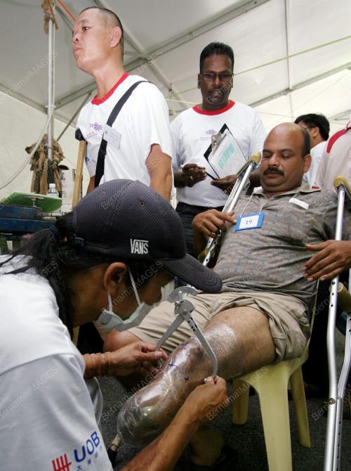FREE PROSTHESIS
