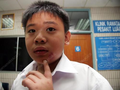PELAJAR CEDERA