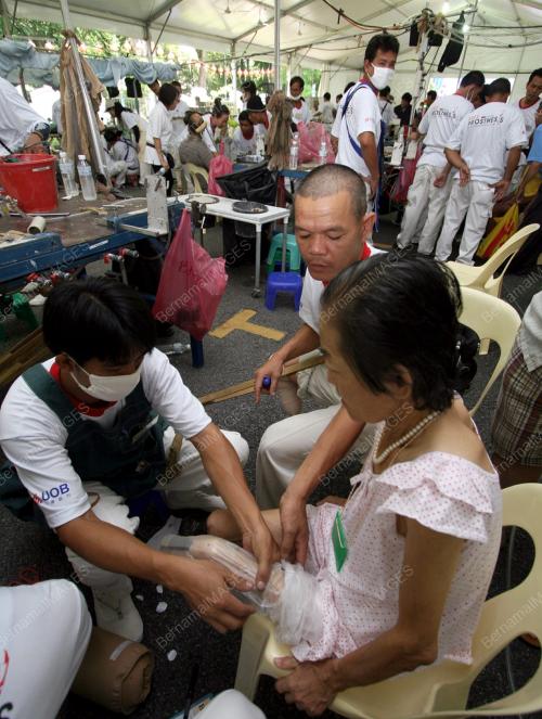 FREE PROSTHESIS
