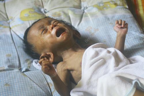 BAYI KEPALA BESAR