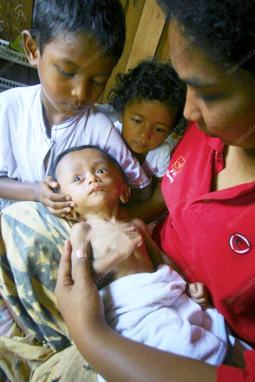 BAYI KEPALA BESAR