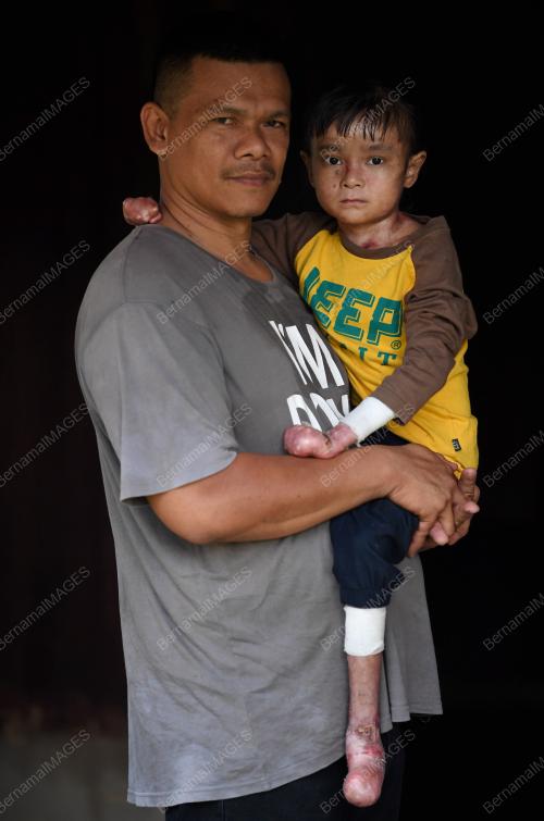 PH11_24022018_PESAKIT