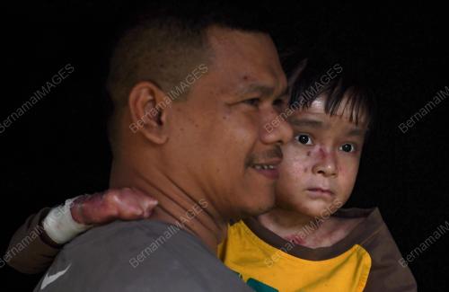 PH12_24022018_PESAKIT