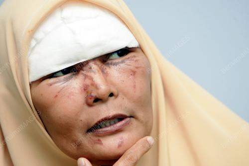 KEMALANGAN