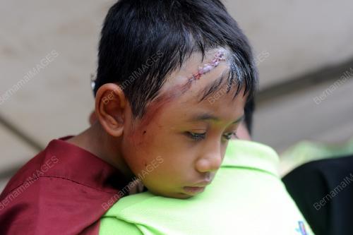 PK17_26072015_KEMALANGAN