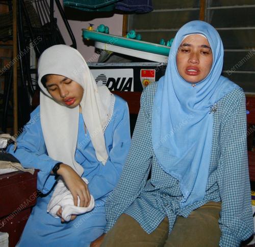 MANGSA KEBAKARAN