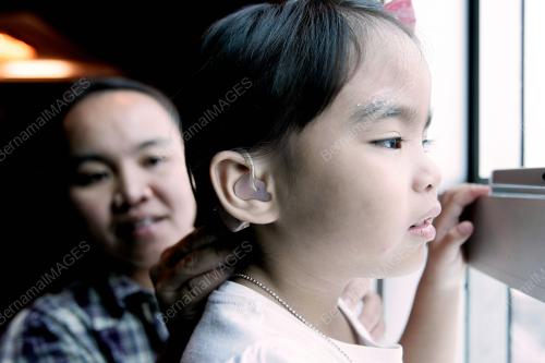 SK01_07102014_KOKLEA