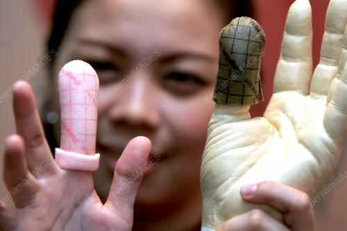 SK02_15082014_WOUND