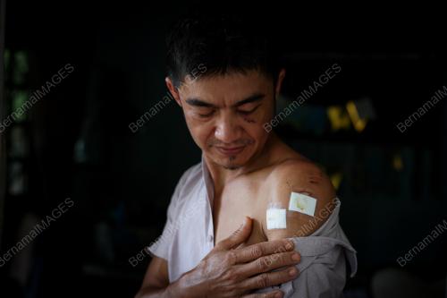 BERUANG_GIGIT
