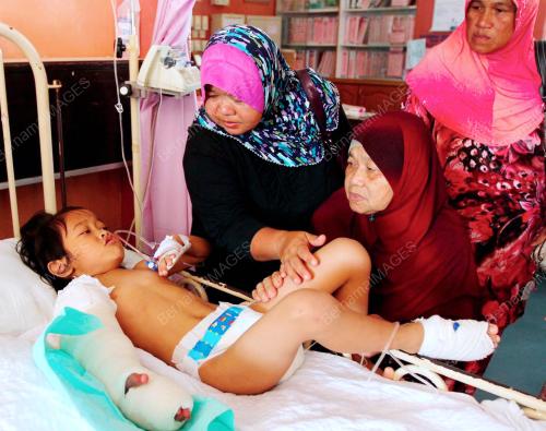 TR01_16122012_TANGAN_BENGKAK