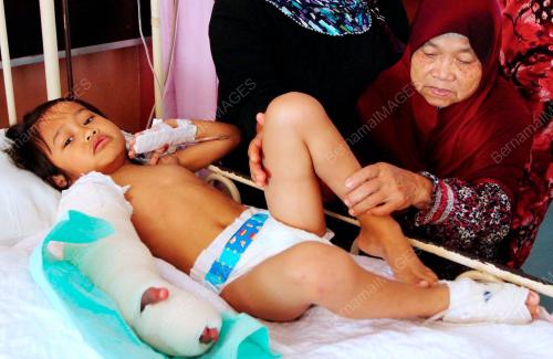 TR02_16122012_TANGAN_BENGKAK