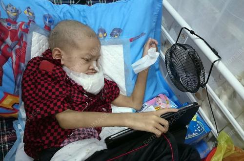 TR02_24092016_PESAKIT_KENSER