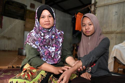 REMAJA SAKIT BUAH PINGGANG