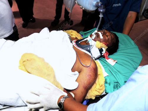 TR03_10052012_CEDERA_TERBAKAR
