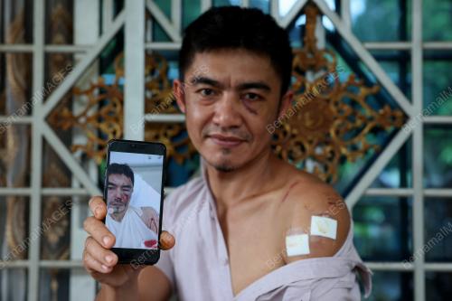 BERUANG_GIGIT