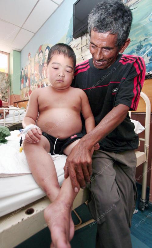 TR04_16022011_BUDAK_SAKIT