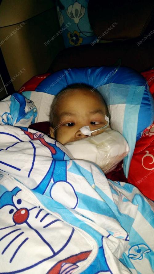 TR07_19102016_KANSER_RAHANG