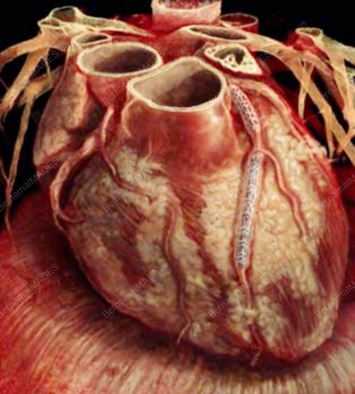 HEART EXHIBITION